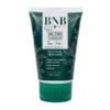 Acne Tea Tree Face Wash